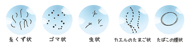 飛蚊症のイメージ